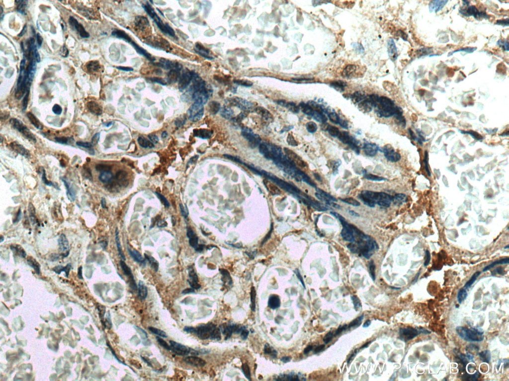 Immunohistochemistry (IHC) staining of human placenta tissue using CSE1L Polyclonal antibody (22219-1-AP)