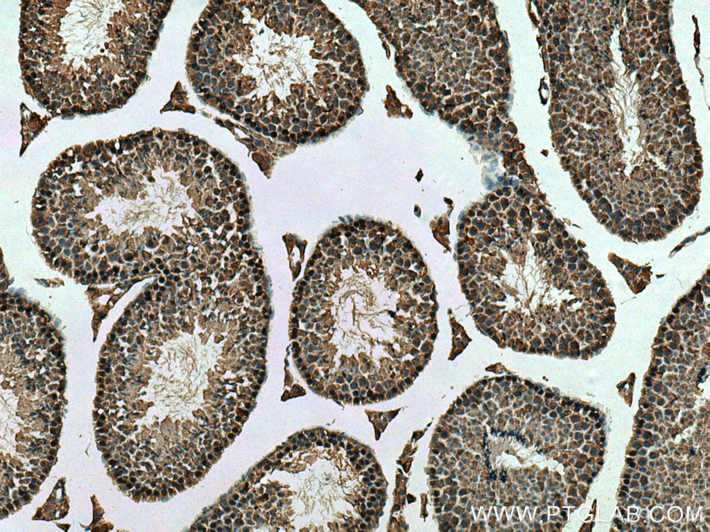 Immunohistochemistry (IHC) staining of mouse testis tissue using CSE1L Polyclonal antibody (22219-1-AP)