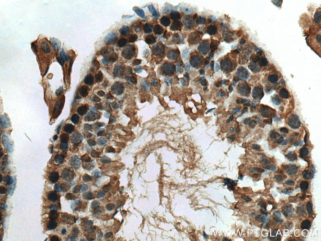 Immunohistochemistry (IHC) staining of mouse testis tissue using CSE1L Polyclonal antibody (22219-1-AP)