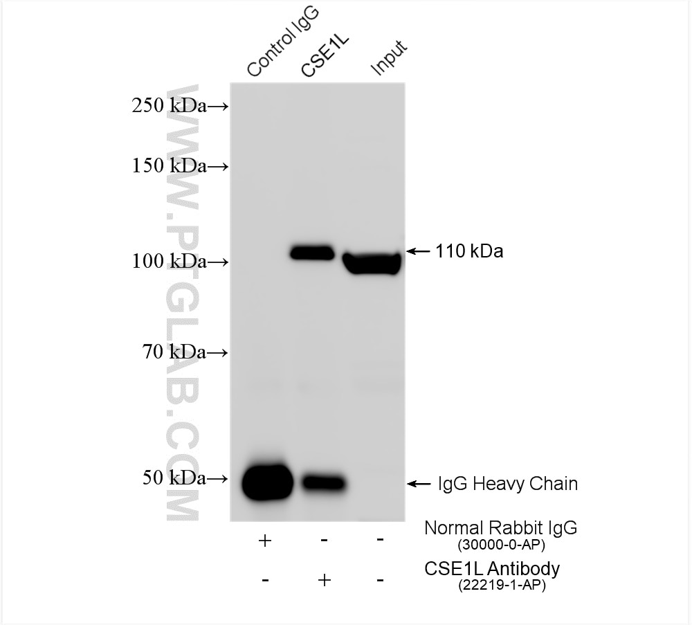 Immunoprecipitation (IP) experiment of HEK-293 cells using CSE1L Polyclonal antibody (22219-1-AP)