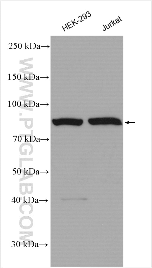 Western Blot (WB) analysis of various lysates using CSE1L Polyclonal antibody (22219-1-AP)