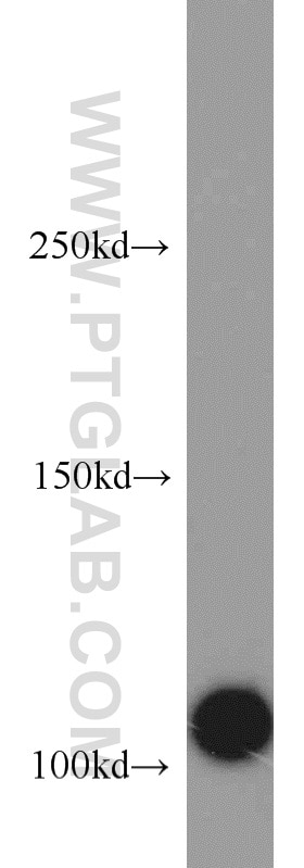 Western Blot (WB) analysis of HeLa cells using CSE1L Polyclonal antibody (22219-1-AP)