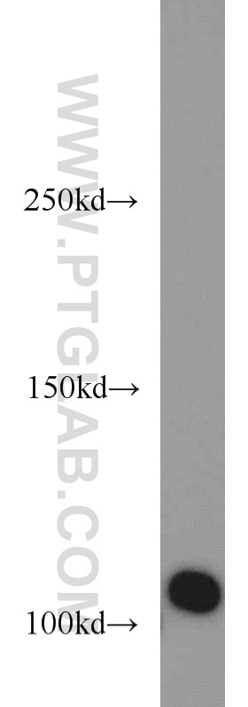 Western Blot (WB) analysis of HEK-293 cells using CSE1L Polyclonal antibody (22219-1-AP)