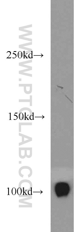 Western Blot (WB) analysis of mouse testis tissue using CSE1L Polyclonal antibody (22219-1-AP)