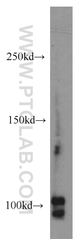 Western Blot (WB) analysis of RAW264.7 using CSE1L Polyclonal antibody (22219-1-AP)