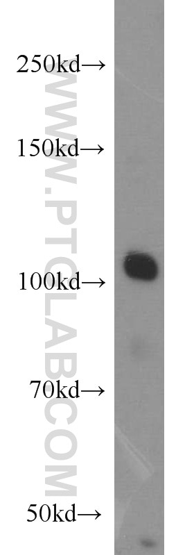 Western Blot (WB) analysis of MCF-7 cells using CSE1L Polyclonal antibody (22219-1-AP)