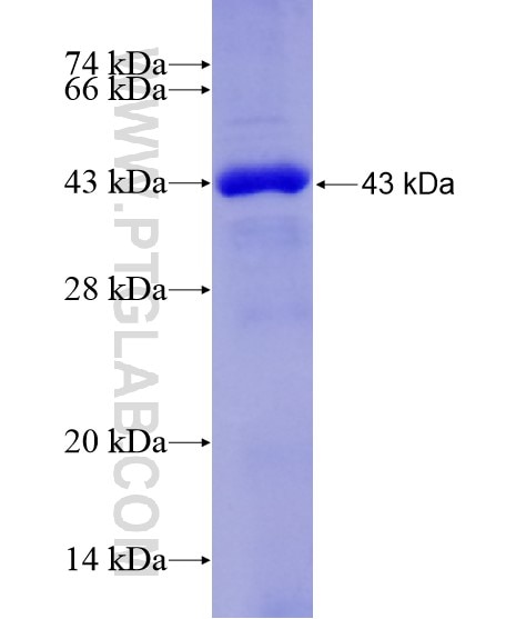 CSE1L fusion protein Ag29131 SDS-PAGE