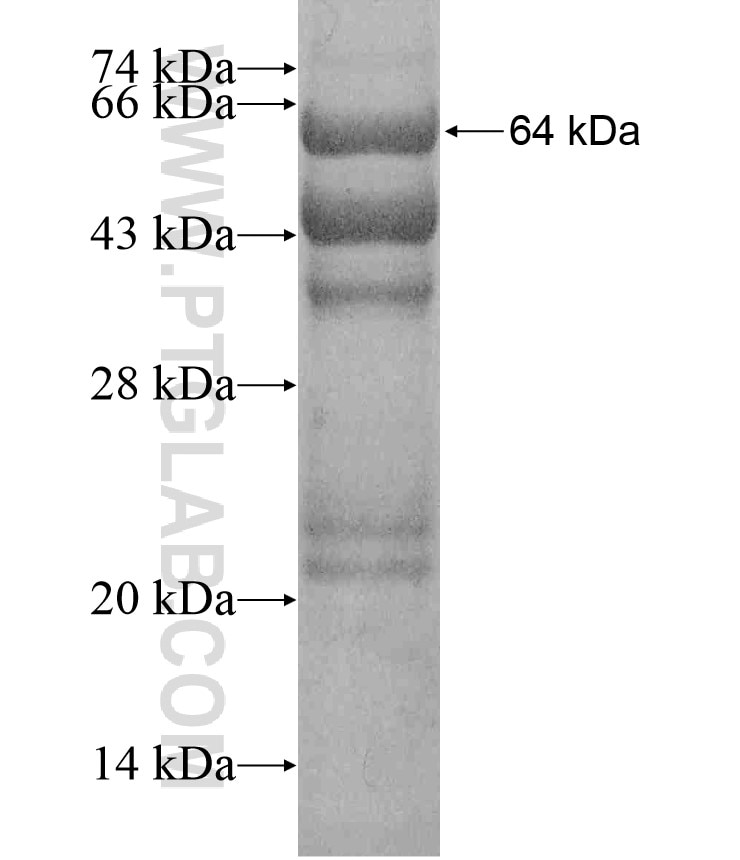 CSE1L fusion protein Ag17556 SDS-PAGE