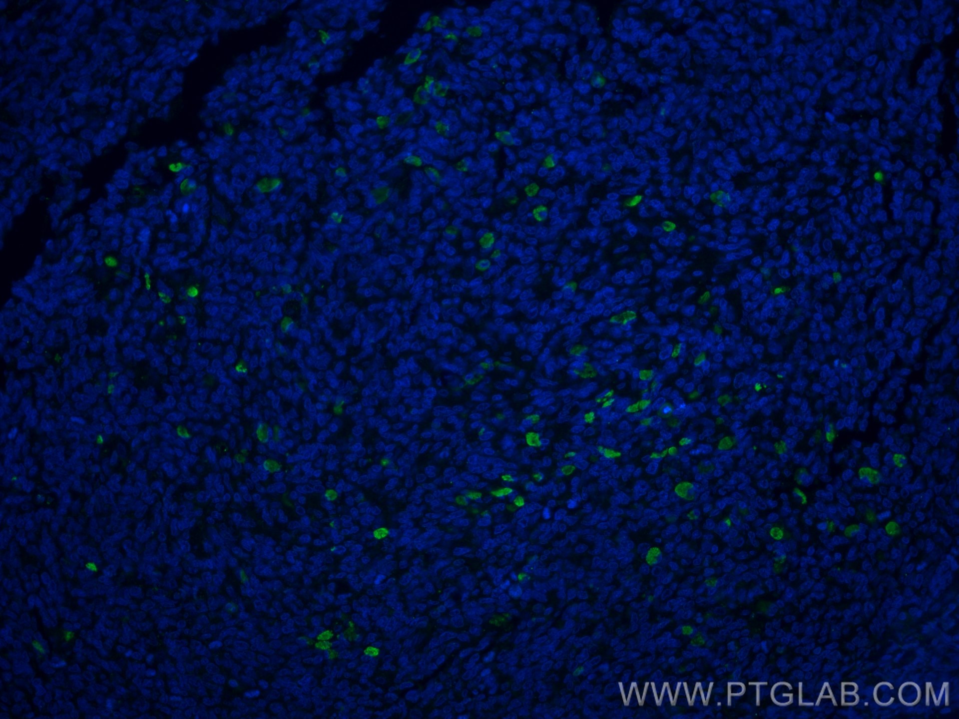 Immunofluorescence (IF) / fluorescent staining of human tonsillitis tissue using CSF1R Polyclonal antibody (25949-1-AP)