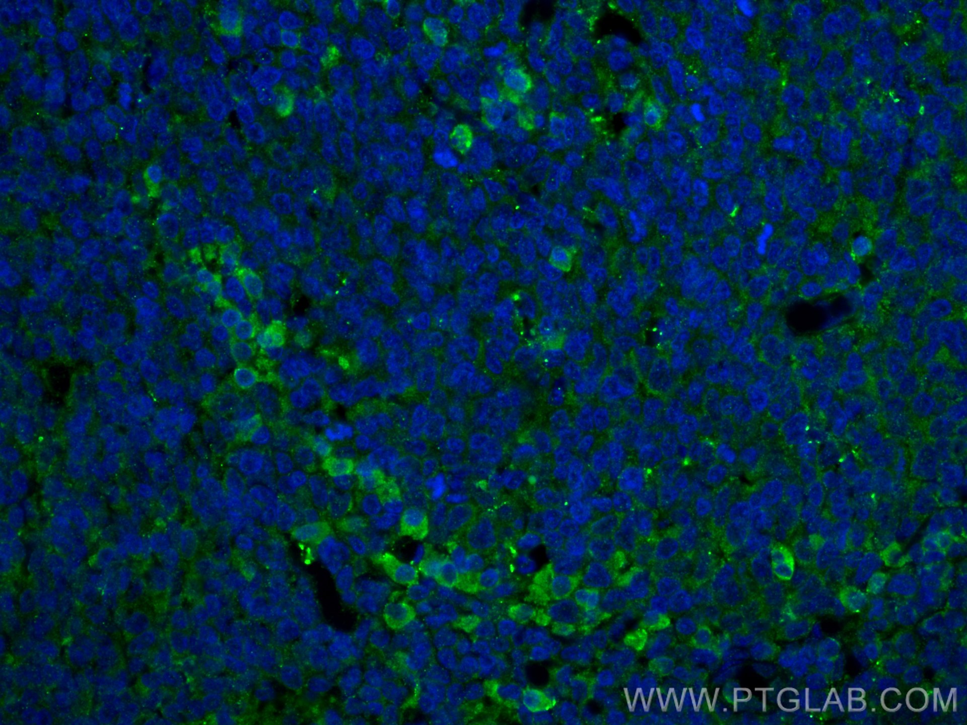 Immunofluorescence (IF) / fluorescent staining of human tonsillitis tissue using CSF1R Polyclonal antibody (25949-1-AP)