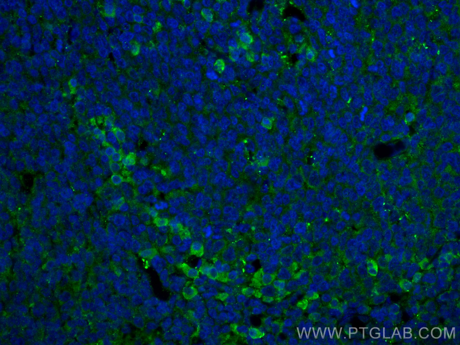 Immunofluorescence (IF) / fluorescent staining of human tonsillitis tissue using CSF1R/CD115 Polyclonal antibody (25949-1-AP)
