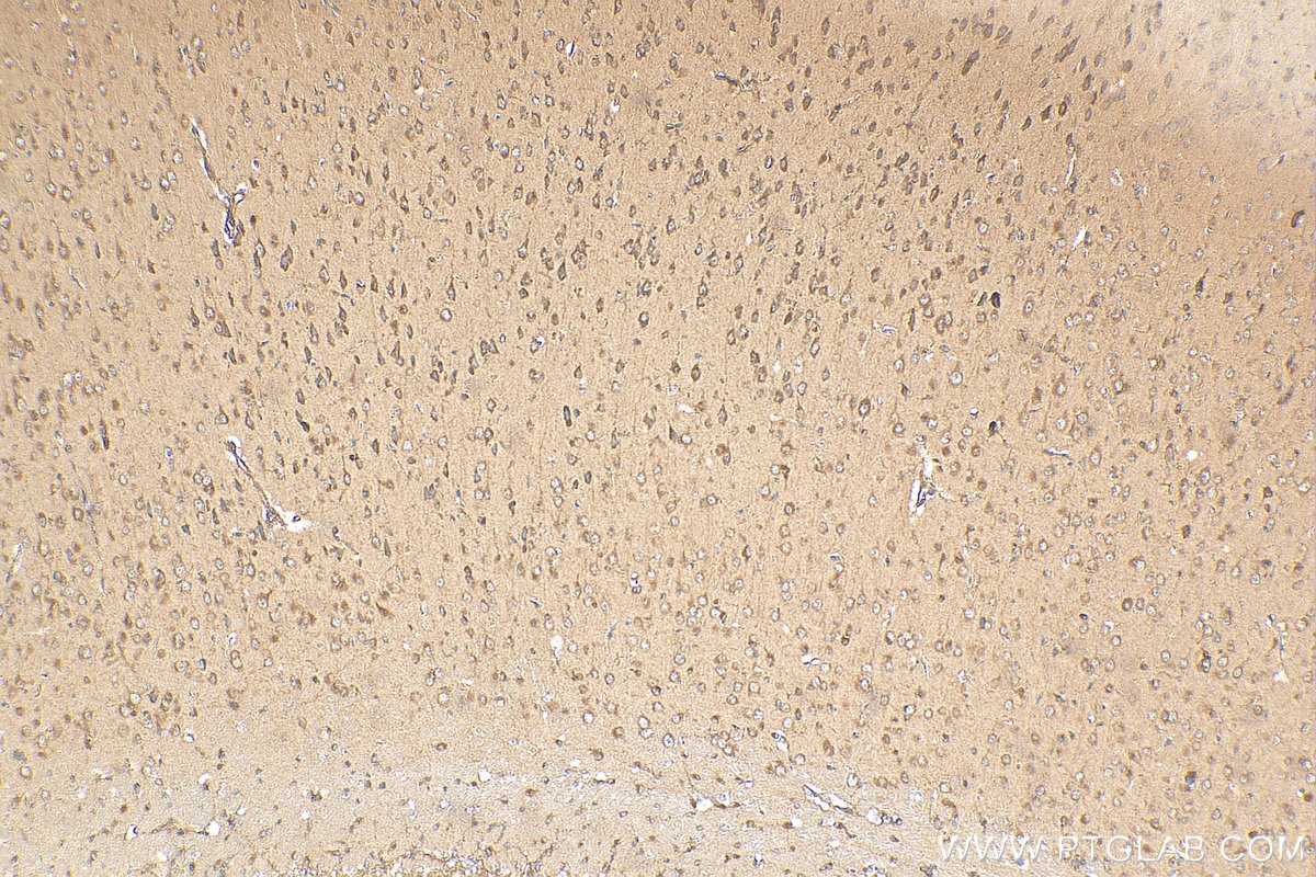 Immunohistochemistry (IHC) staining of mouse brain tissue using CSF1R Polyclonal antibody (25949-1-AP)