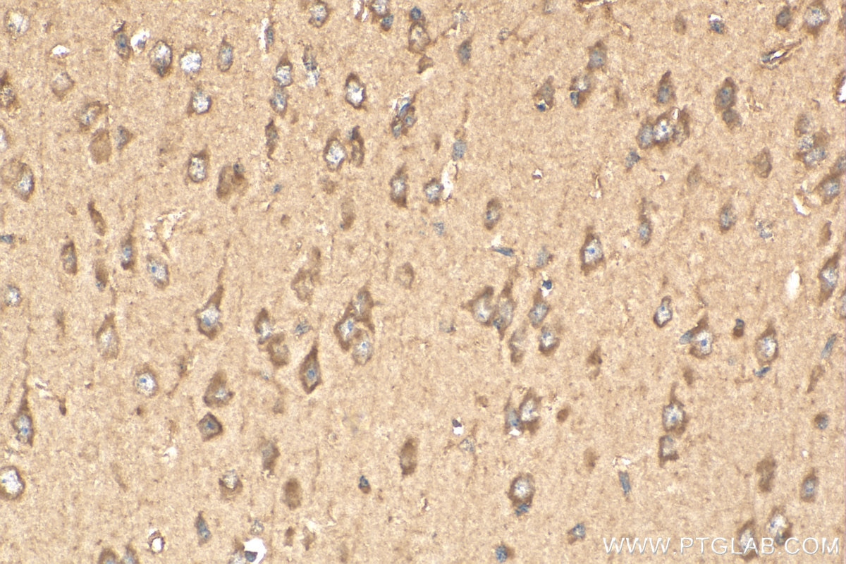 Immunohistochemistry (IHC) staining of mouse brain tissue using CSF1R Polyclonal antibody (25949-1-AP)