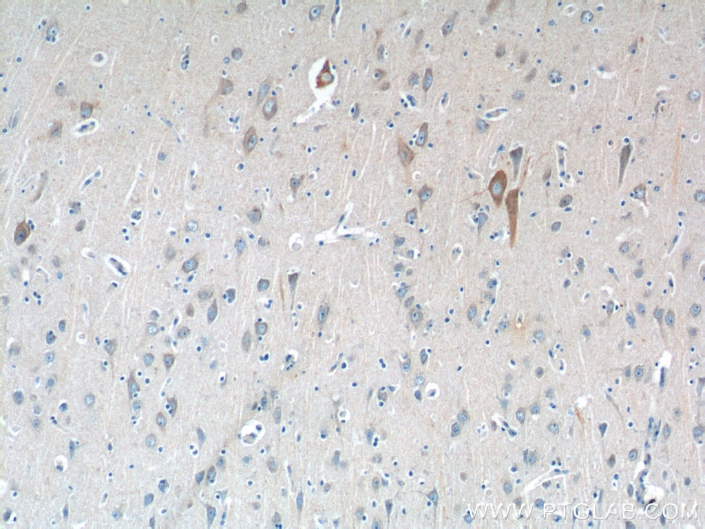 Immunohistochemistry (IHC) staining of human brain tissue using CSF1R Polyclonal antibody (25949-1-AP)