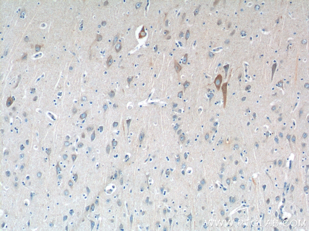 IHC staining of human brain using 25949-1-AP