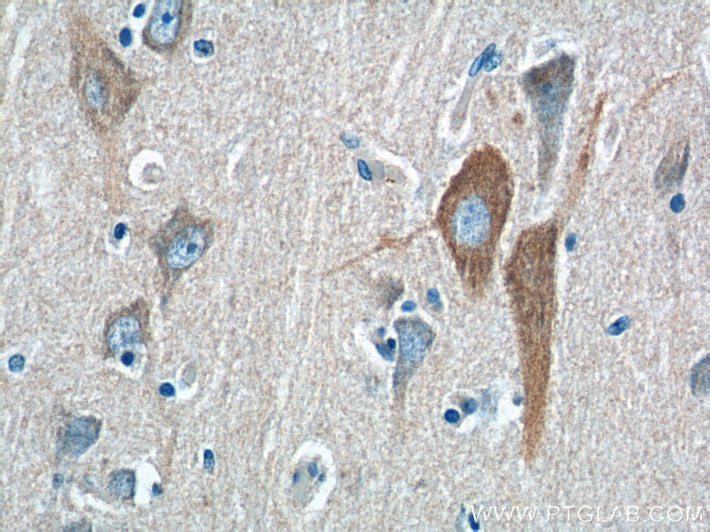 IHC staining of human brain using 25949-1-AP