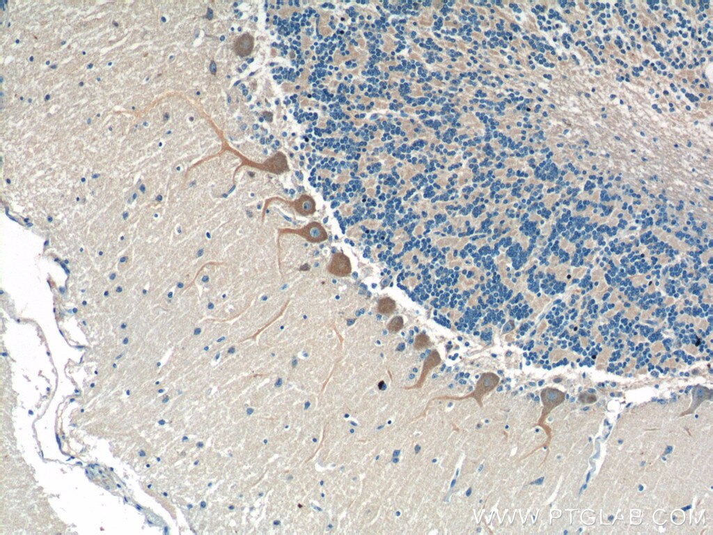 Immunohistochemistry (IHC) staining of human cerebellum tissue using CSF1R Polyclonal antibody (25949-1-AP)