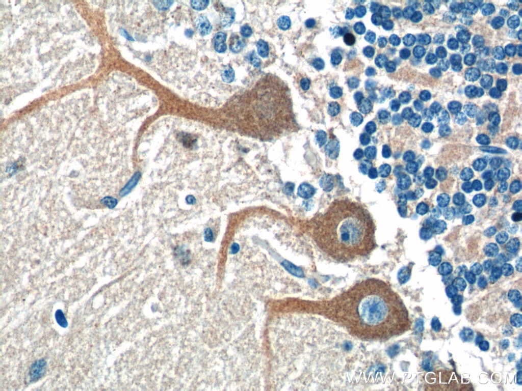 Immunohistochemistry (IHC) staining of human cerebellum tissue using CSF1R Polyclonal antibody (25949-1-AP)