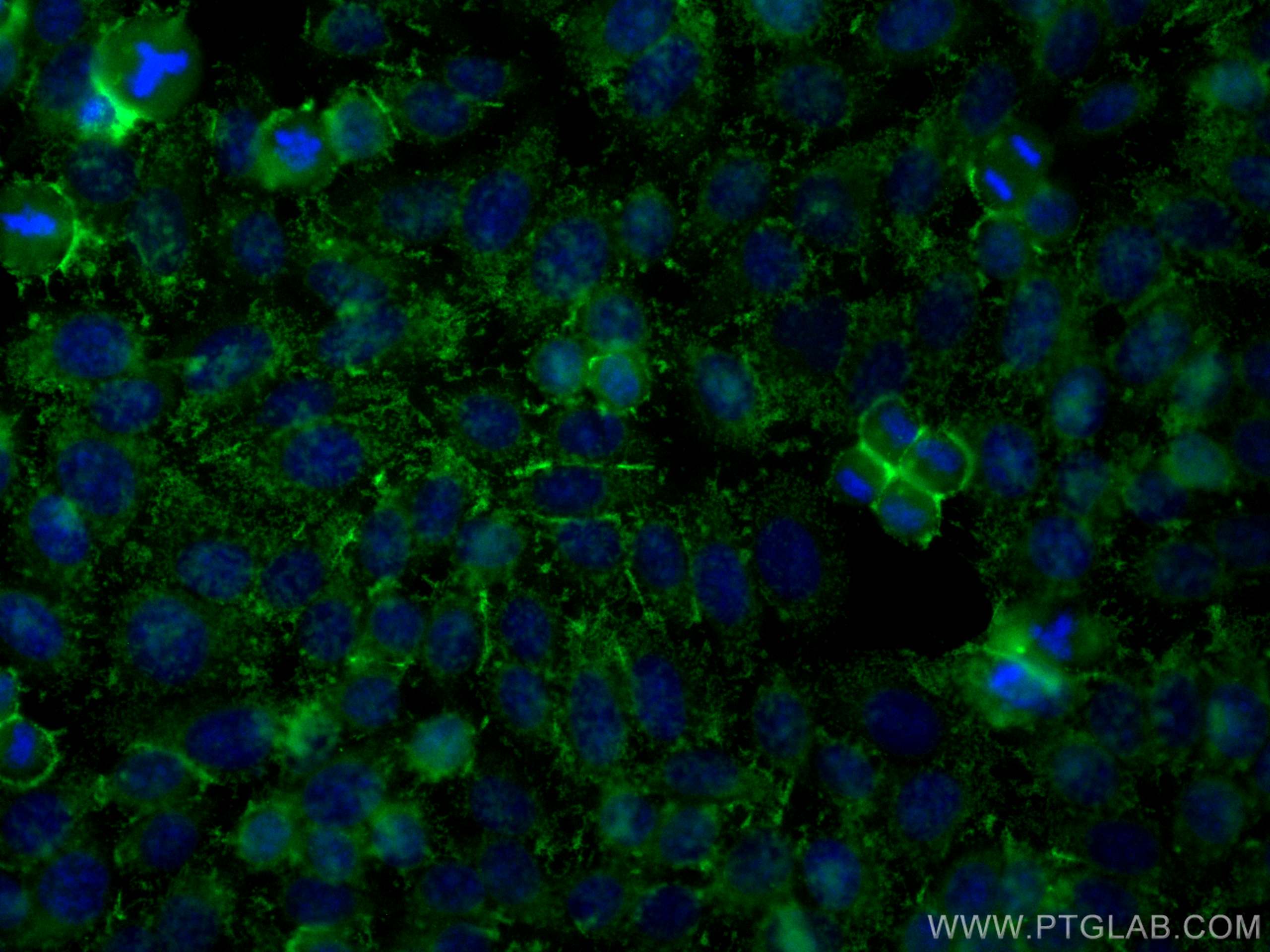 Immunofluorescence (IF) / fluorescent staining of HepG2 cells using CoraLite® Plus 488-conjugated CSF1R Polyclonal ant (CL488-25949)