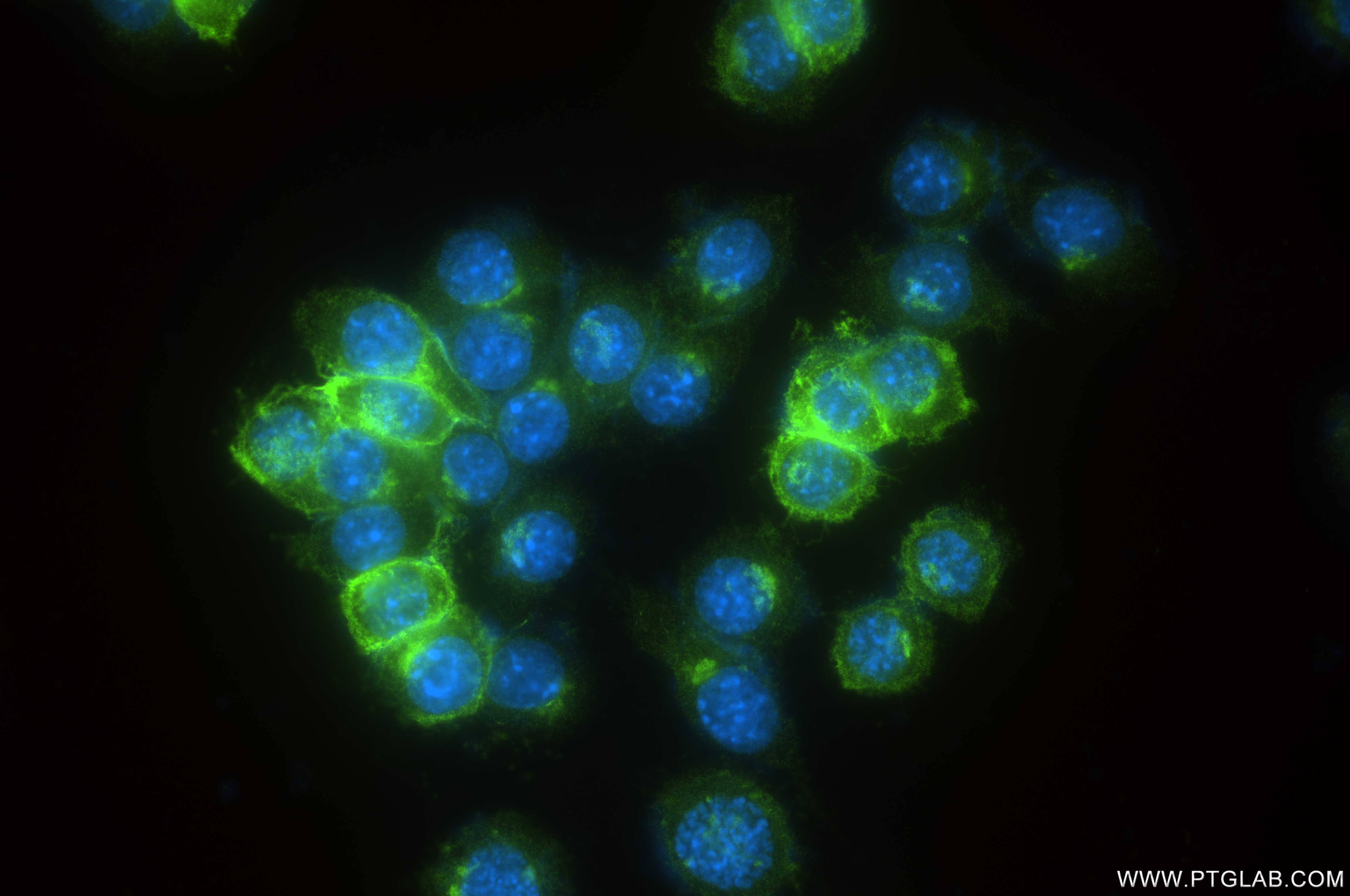 Immunofluorescence (IF) / fluorescent staining of RAW 264.7 cells using CSF1R/CD115 Recombinant antibody (84919-1-RR)