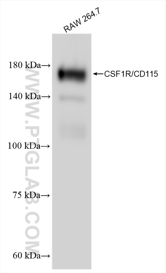Western Blot (WB) analysis of various lysates using CSF1R/CD115 Recombinant antibody (84919-1-RR)