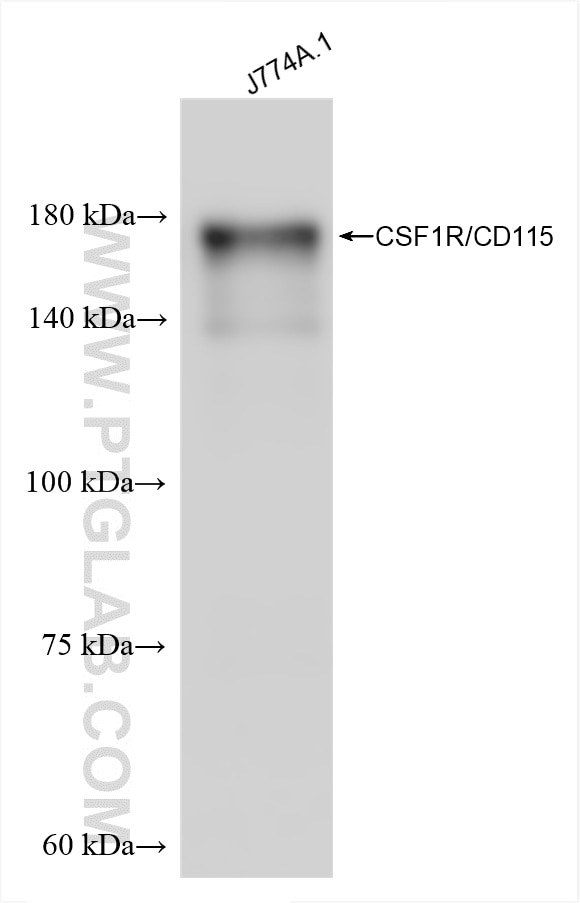 Western Blot (WB) analysis of various lysates using CSF1R/CD115 Recombinant antibody (84919-1-RR)