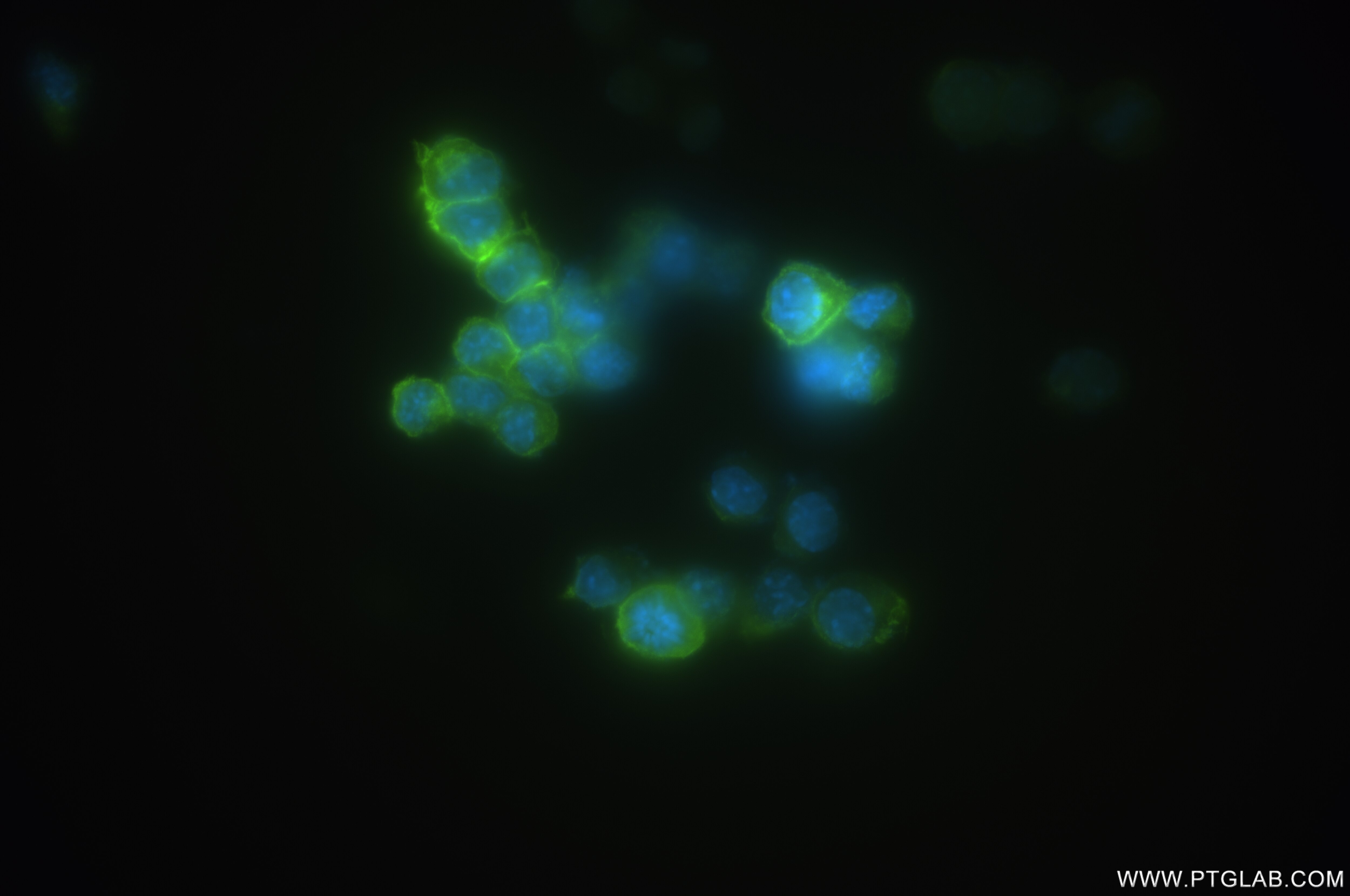 Immunofluorescence (IF) / fluorescent staining of RAW 264.7 cells using CSF1R/CD115 Recombinant antibody (84919-4-RR)