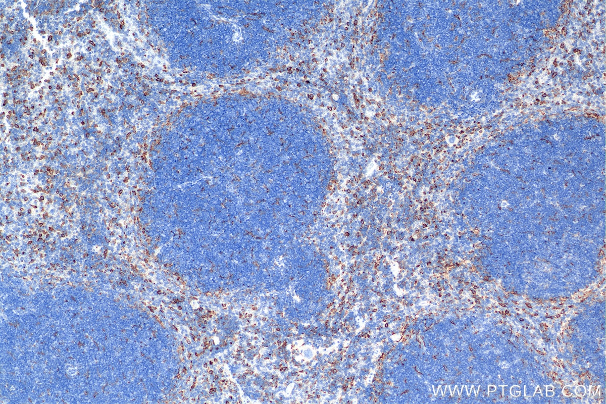 Immunohistochemical analysis of paraffin-embedded mouse spleen tissue slide using 84919-6-RR (M-CSF R/CD115 antibody) at dilution of 1:1000 (under 10x lens). Heat mediated antigen retrieval with Tris-EDTA buffer (pH 9.0). Immunohistochemistry (IHC) staining of mouse spleen tissue using CSF1R/CD115 Recombinant monoclonal antibody (84919-6-RR)