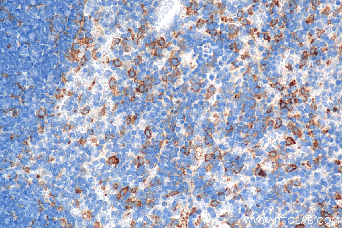 Immunohistochemical analysis of paraffin-embedded mouse spleen tissue slide using 84919-6-RR (M-CSF R/CD115 antibody) at dilution of 1:1000 (under 40x lens). Heat mediated antigen retrieval with Tris-EDTA buffer (pH 9.0). Immunohistochemistry (IHC) staining of mouse spleen tissue using CSF1R/CD115 Recombinant monoclonal antibody (84919-6-RR)