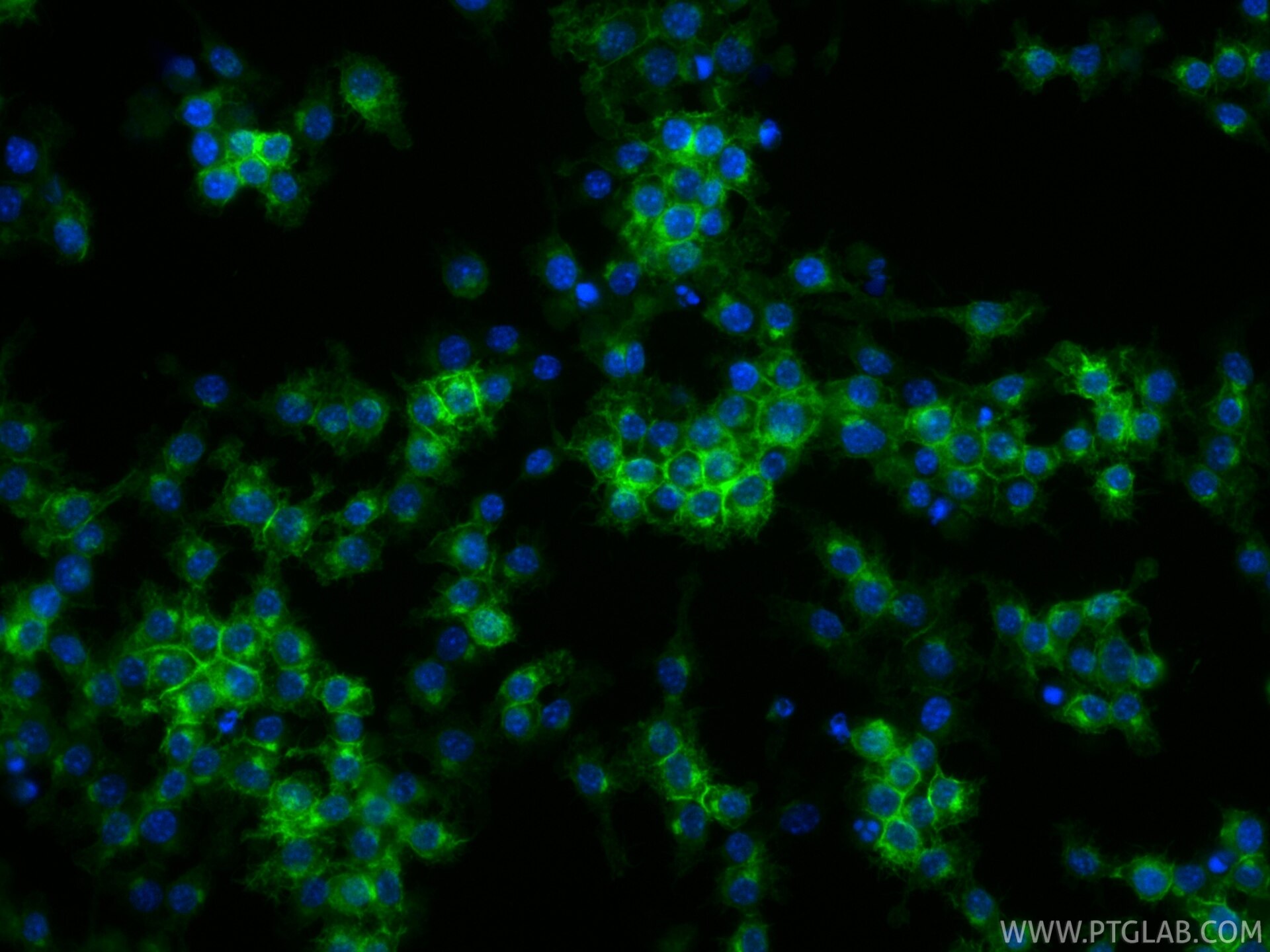 IF Staining of RAW 264.7 using CL488-84919-4 Immunofluorescence (IF) / fluorescent staining of RAW 264.7 cells using CoraLite® Plus 488-conjugated CSF1R/CD115 Recombin (CL488-84919-4)