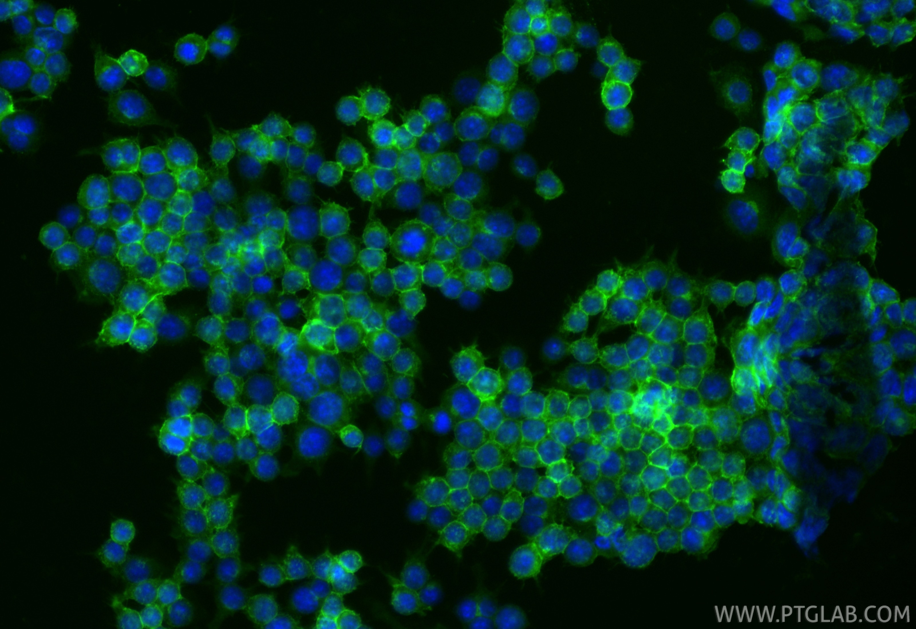 Immunofluorescent analysis of (-20°C Ethanol) fixed RAW 264.7 cells using CoraLite® Plus 488 CSF1R/CD115 antibody (CL488-84919, Clone: 242213B1 ) at dilution of 1:200. Immunofluorescence (IF) / fluorescent staining of RAW 264.7 cells using CoraLite® Plus 488-conjugated CSF1R/CD115 Recombin (CL488-84919)
