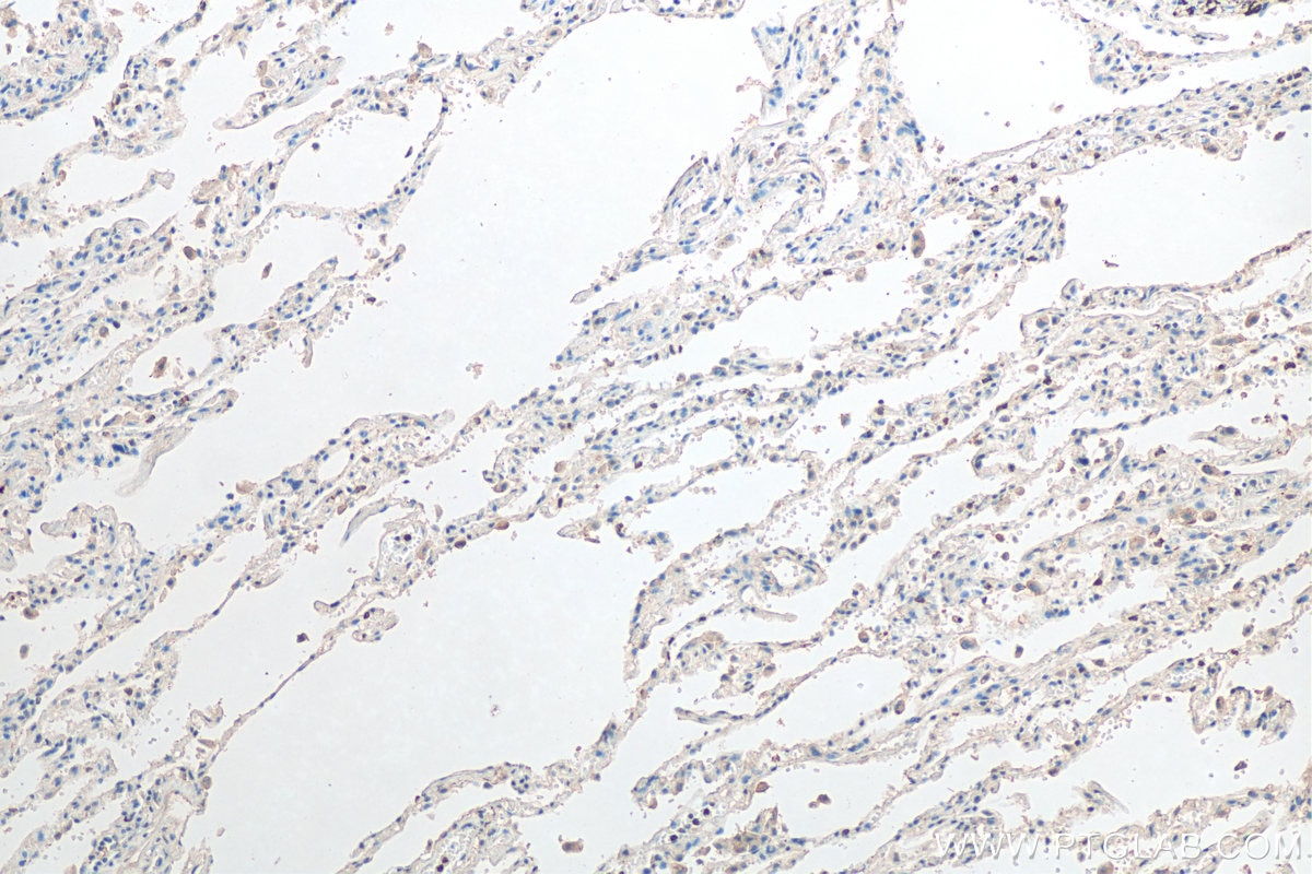 Immunohistochemistry (IHC) staining of human lung tissue using GM-CSF Polyclonal antibody (17762-1-AP)