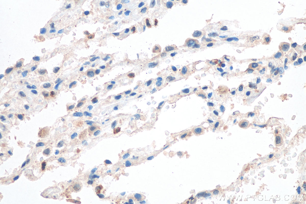 Immunohistochemistry (IHC) staining of human lung tissue using GM-CSF Polyclonal antibody (17762-1-AP)