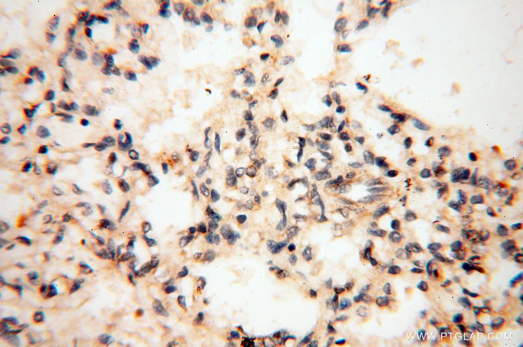 GM-CSF Polyclonal antibody