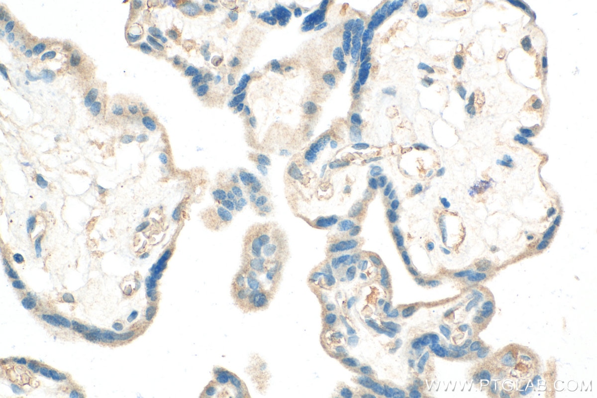 Immunohistochemistry (IHC) staining of human placenta tissue using CSF2RA/CD116 Polyclonal antibody (18307-1-AP)
