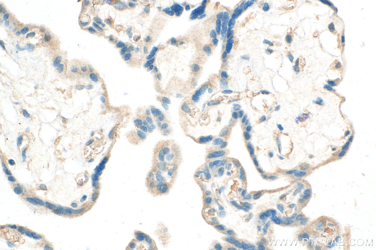 IHC staining of human placenta using 18307-1-AP