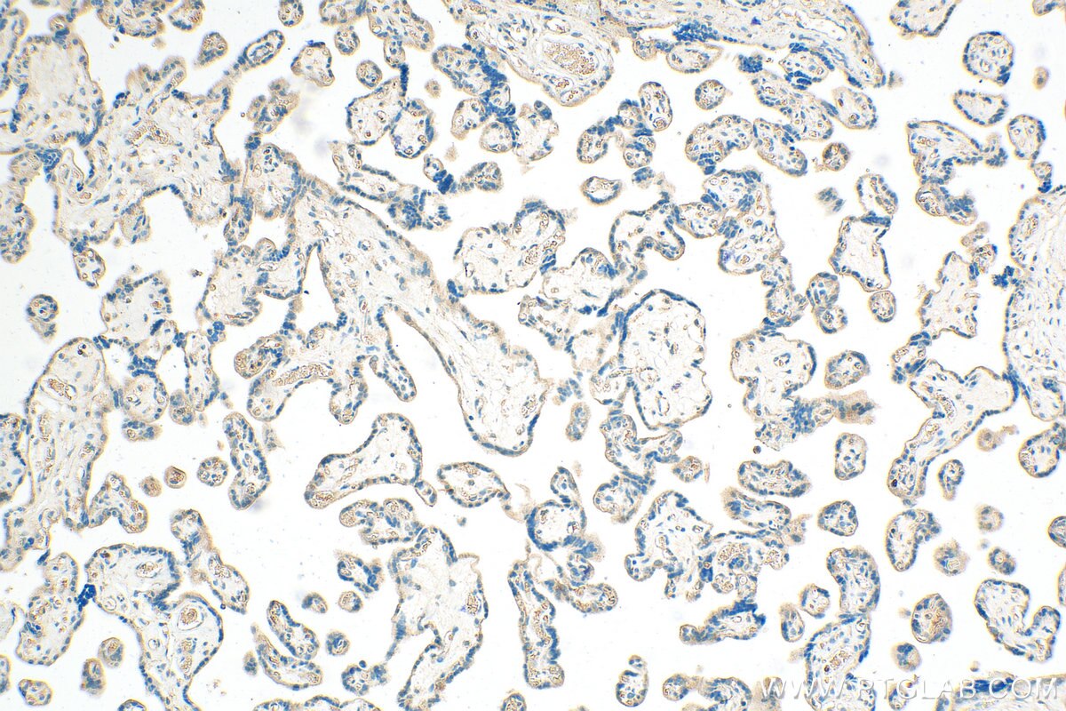 IHC staining of human placenta using 18307-1-AP