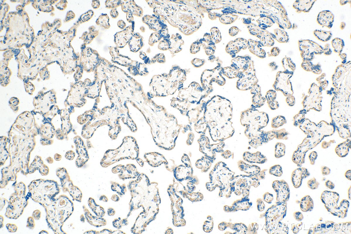 Immunohistochemistry (IHC) staining of human placenta tissue using CSF2RA/CD116 Polyclonal antibody (18307-1-AP)