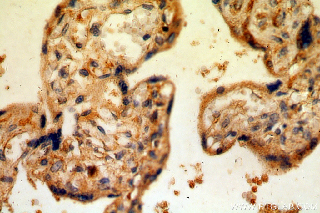 CSF2RA/CD116