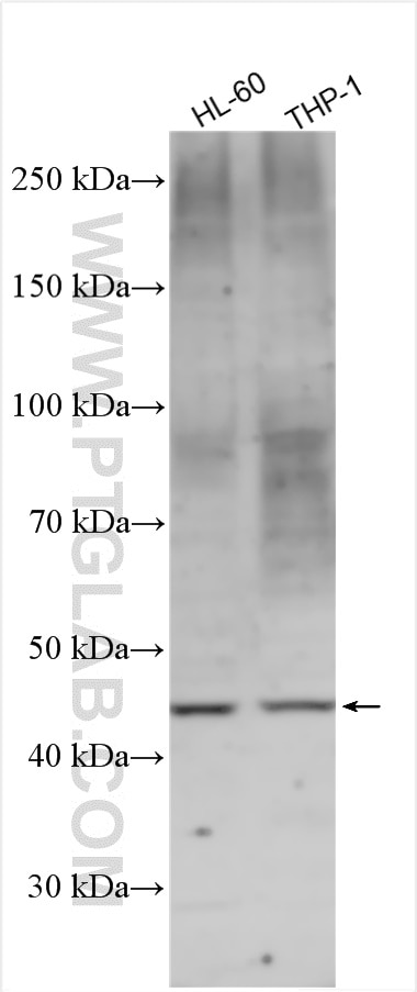 Western Blot (WB) analysis of various lysates using CSF2RA/CD116 Polyclonal antibody (18307-1-AP)