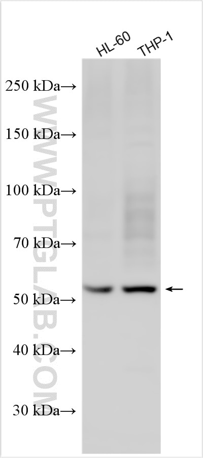 Western Blot (WB) analysis of various lysates using CSF2RA/CD116 Polyclonal antibody (18307-1-AP)