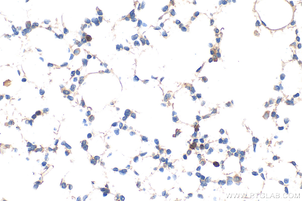 IHC staining of mouse lung using 32058-1-AP Immunohistochemistry (IHC) staining of mouse lung tissue using CSF2RA/CD116 Polyclonal antibody (32058-1-AP)