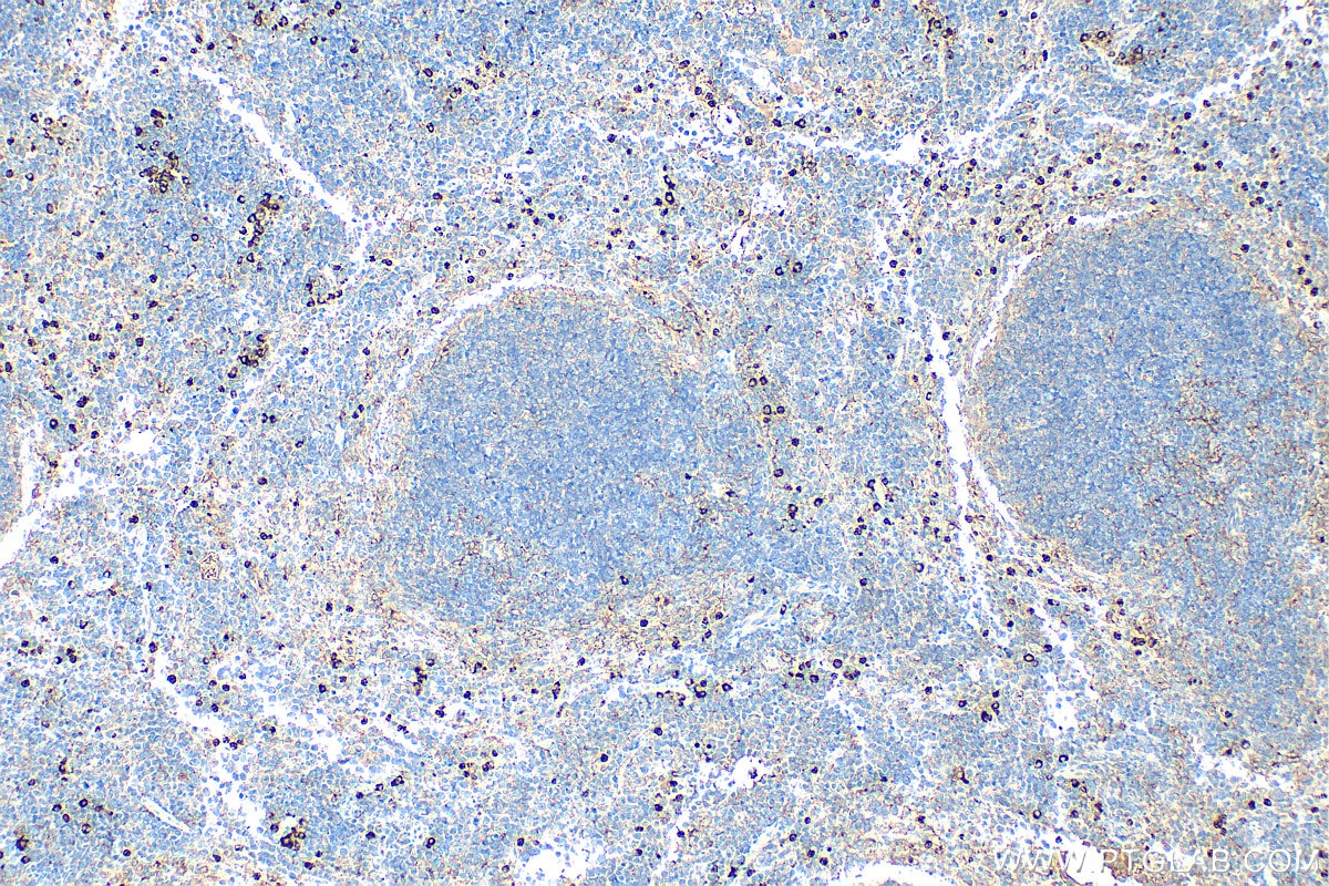 IHC staining of mouse spleen using 32058-1-AP Immunohistochemistry (IHC) staining of mouse spleen tissue using CSF2RA/CD116 Polyclonal antibody (32058-1-AP)