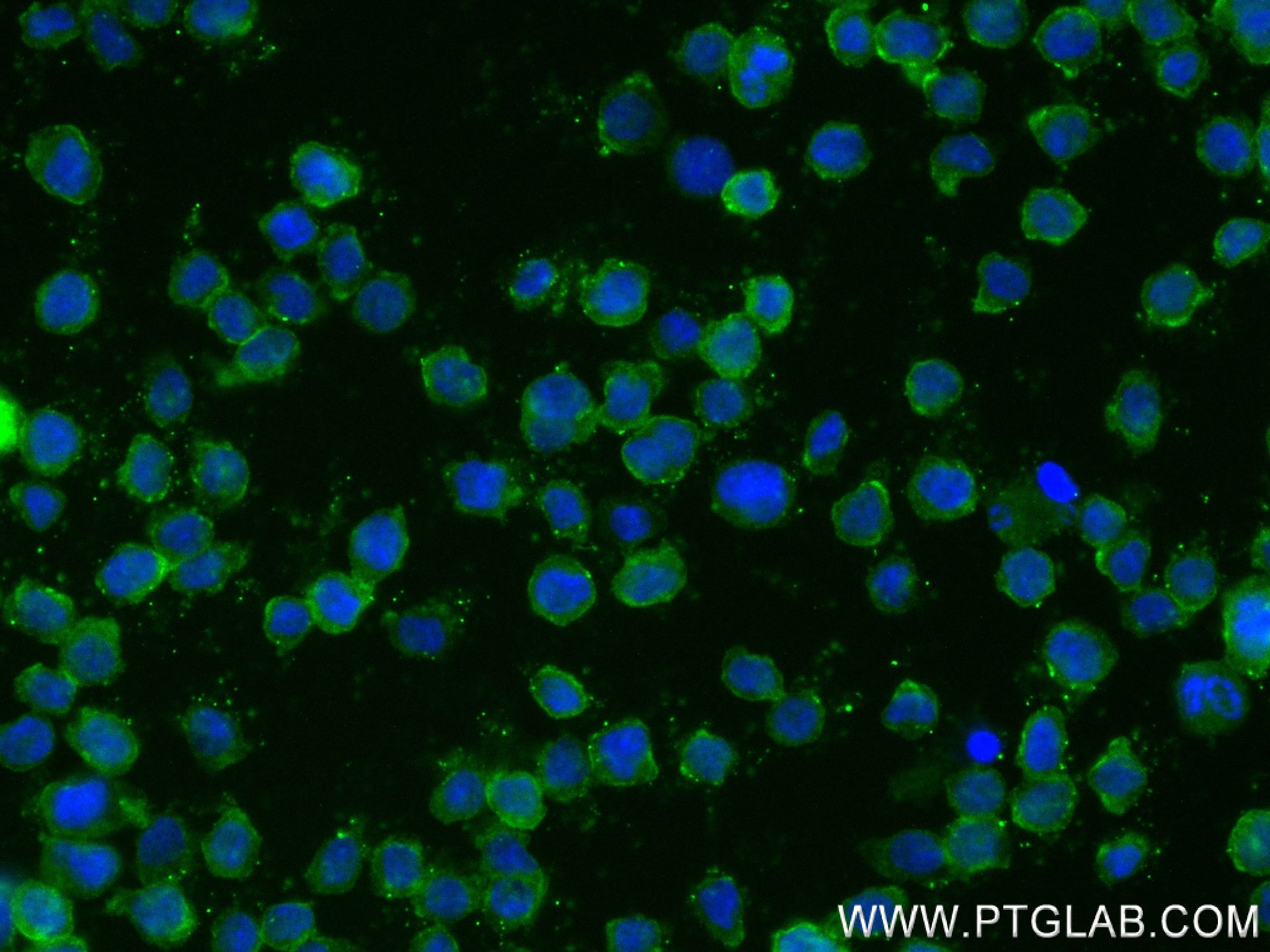 Immunofluorescence (IF) / fluorescent staining of THP-1 cells using CSF2RA/CD116 Recombinant antibody (84023-1-RR)
