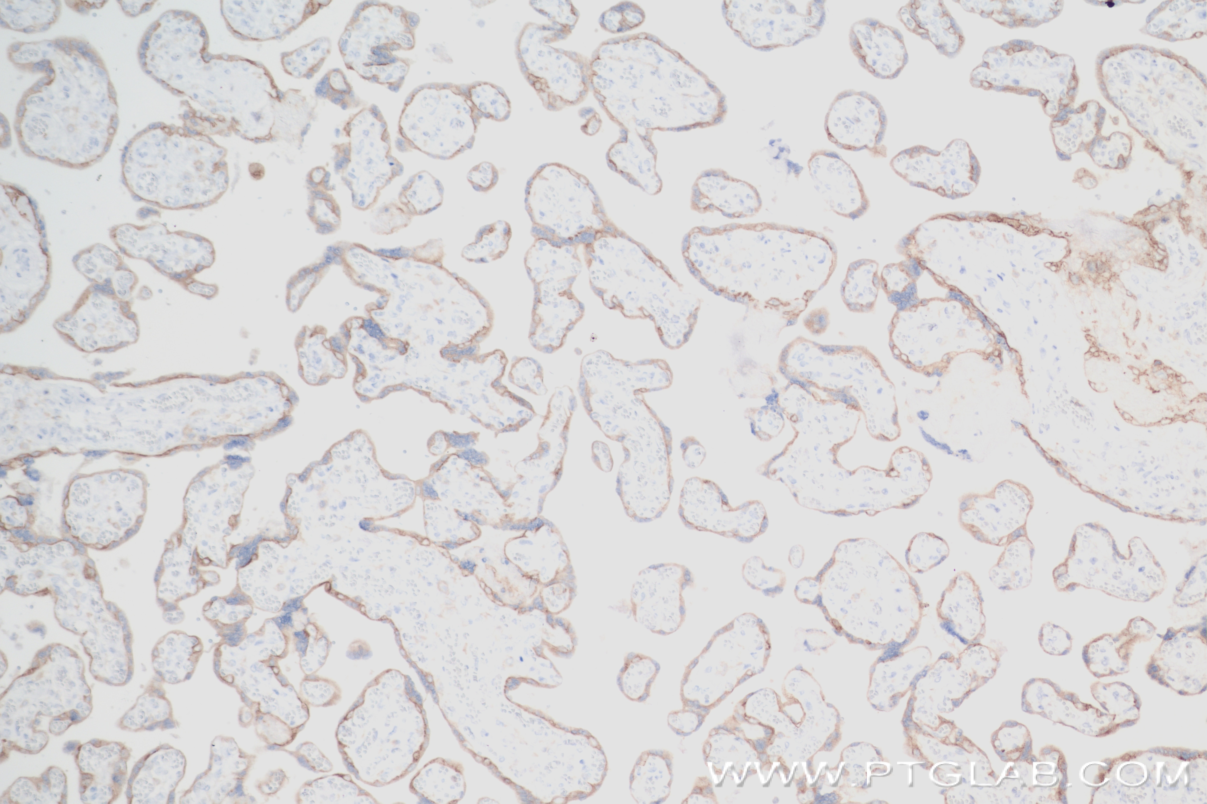 Immunohistochemistry (IHC) staining of human placenta tissue using CSF2RA/CD116 Recombinant antibody (84023-1-RR)