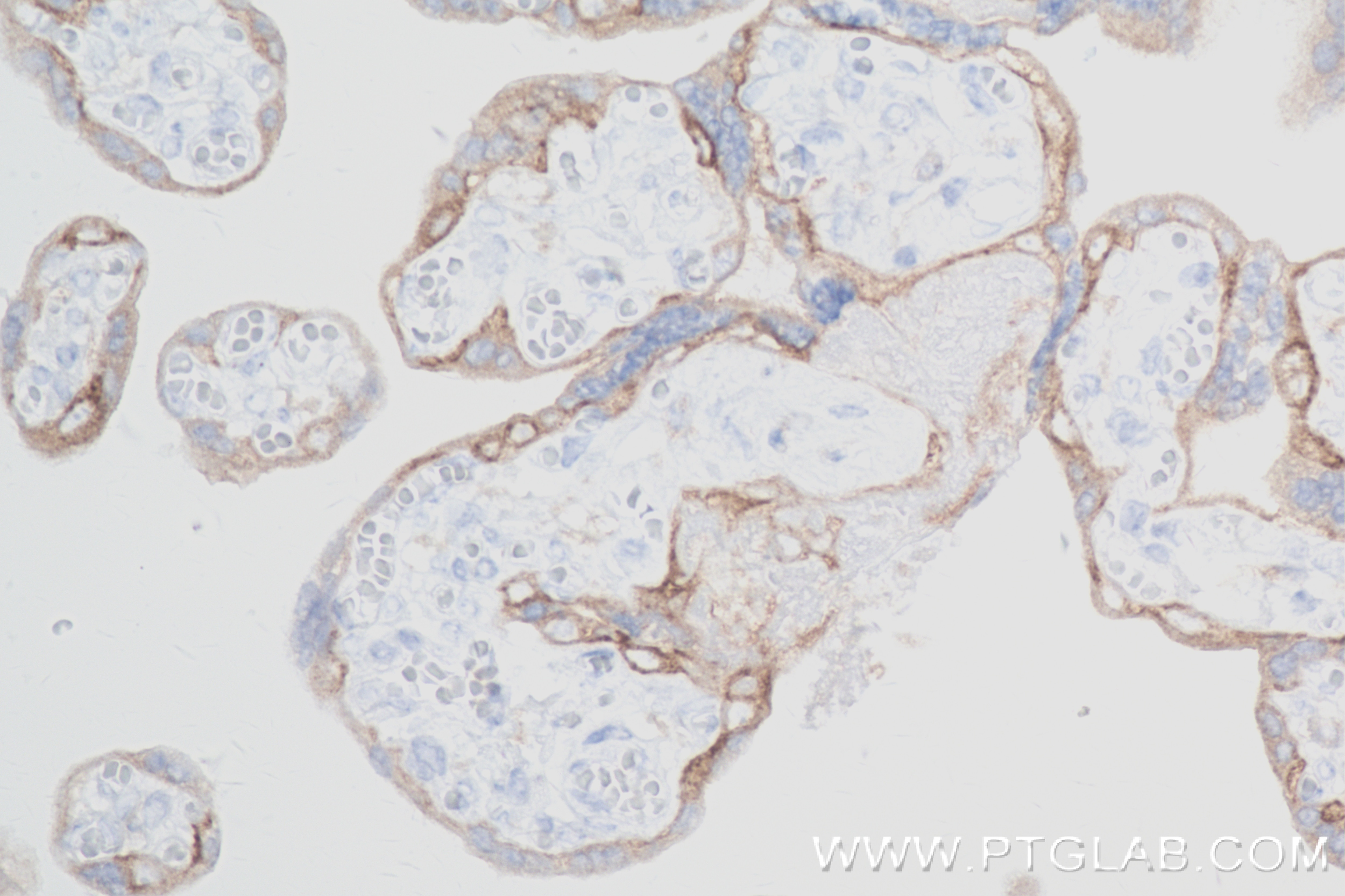 Immunohistochemistry (IHC) staining of human placenta tissue using CSF2RA/CD116 Recombinant antibody (84023-1-RR)