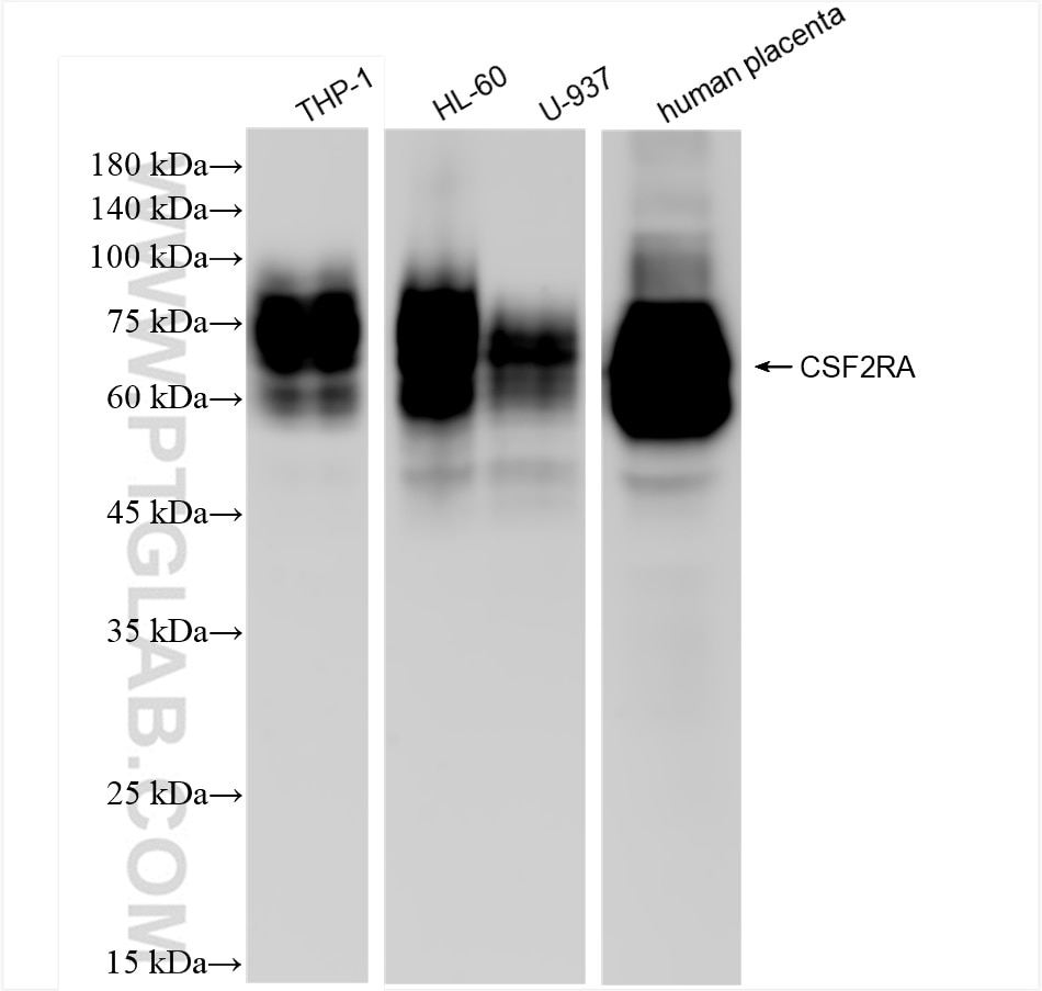 Western Blot (WB) analysis of various lysates using CSF2RA/CD116 Recombinant antibody (84023-1-RR)