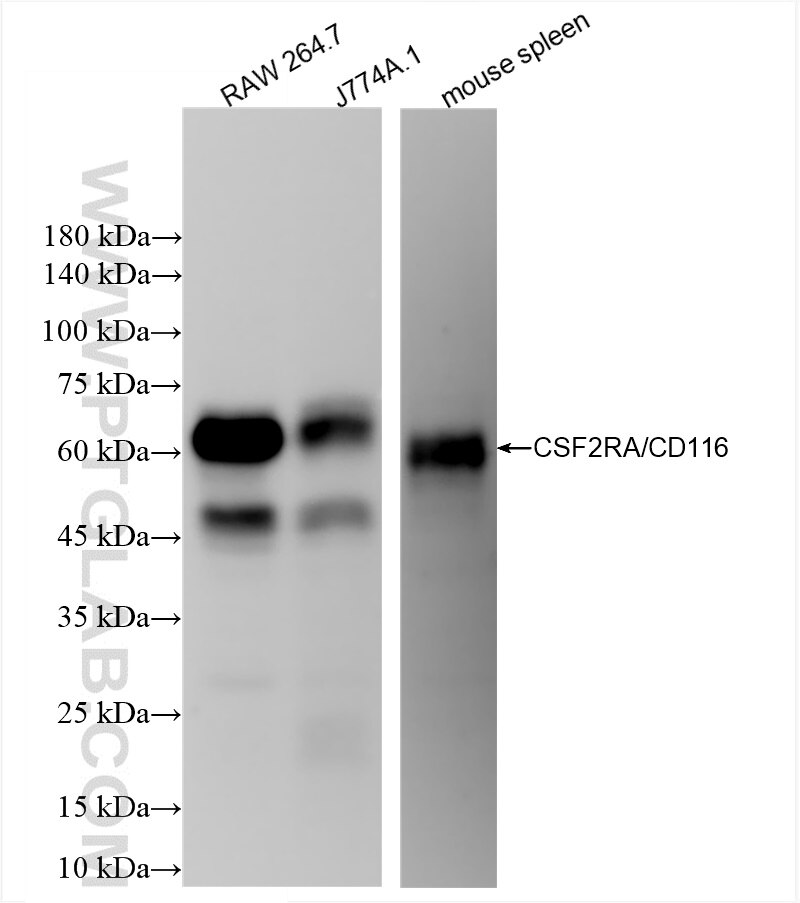 Western Blot (WB) analysis of various lysates using CSF2RA/CD116 Recombinant antibody (84483-6-RR)