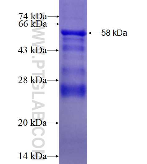 CSF2RB fusion protein Ag25914 SDS-PAGE