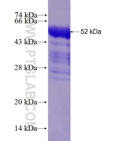 CSF2RB fusion protein Ag28159 SDS-PAGE